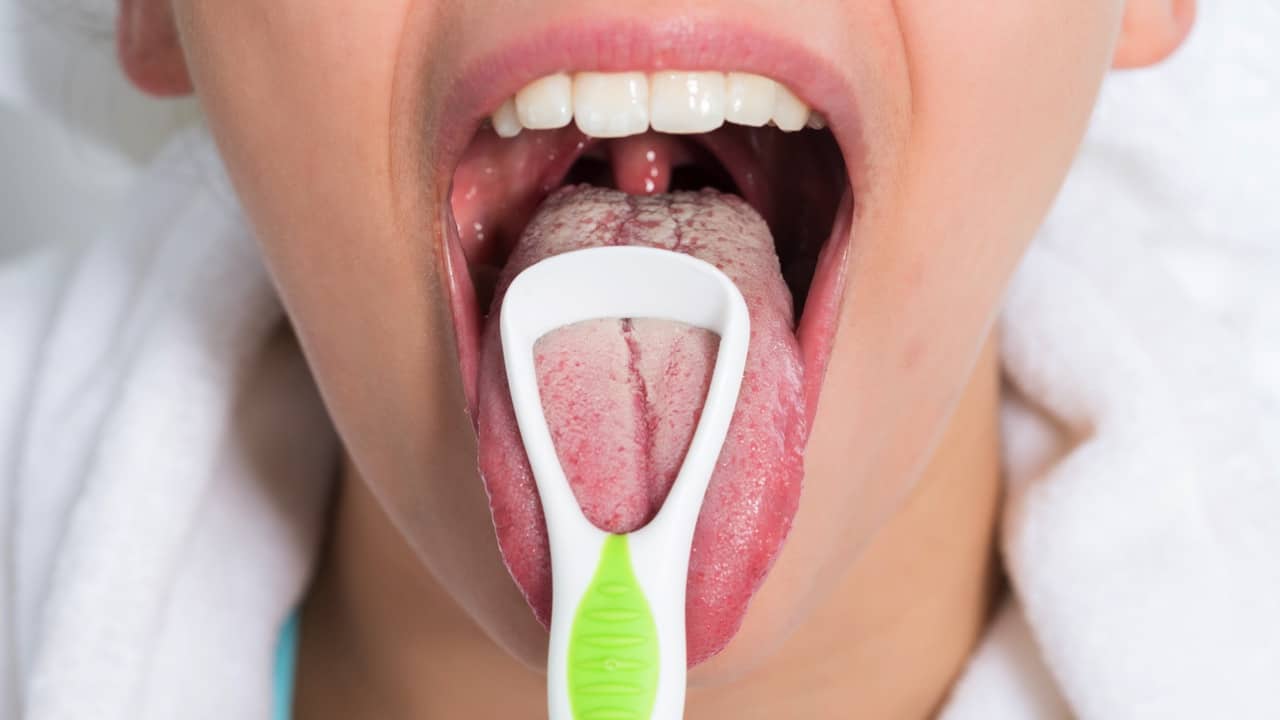 hvid Limited Brace White Tongue: What Causes It, and Is It Curable? - GoodRx