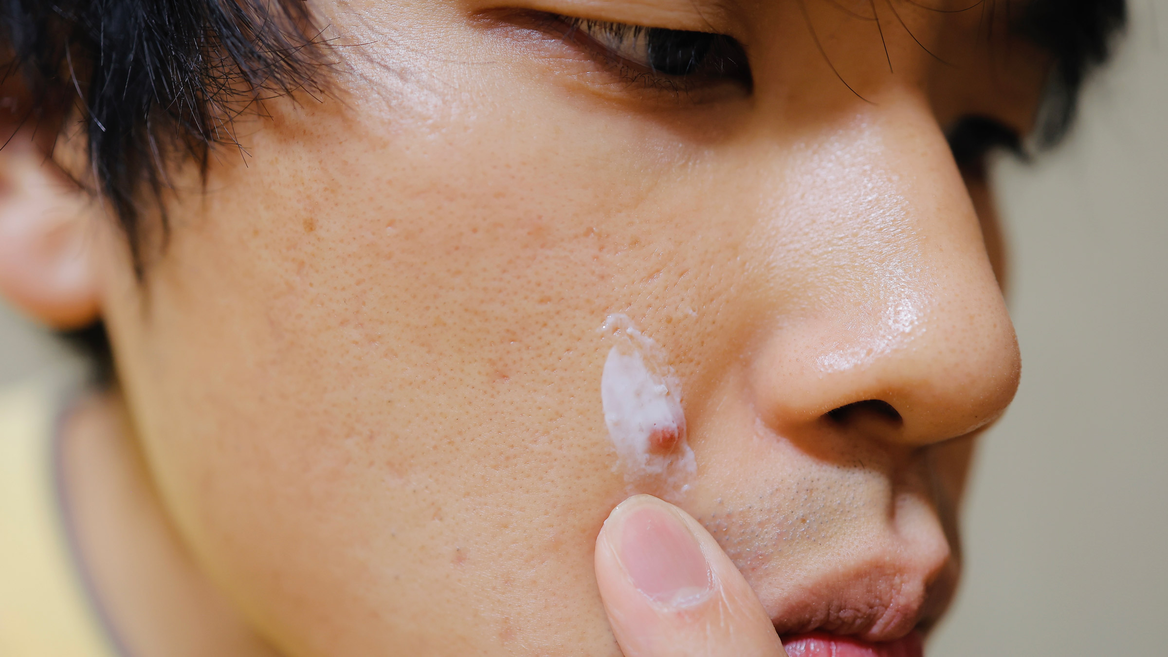 Retinol For Acne: Safety, Side Effects, Products