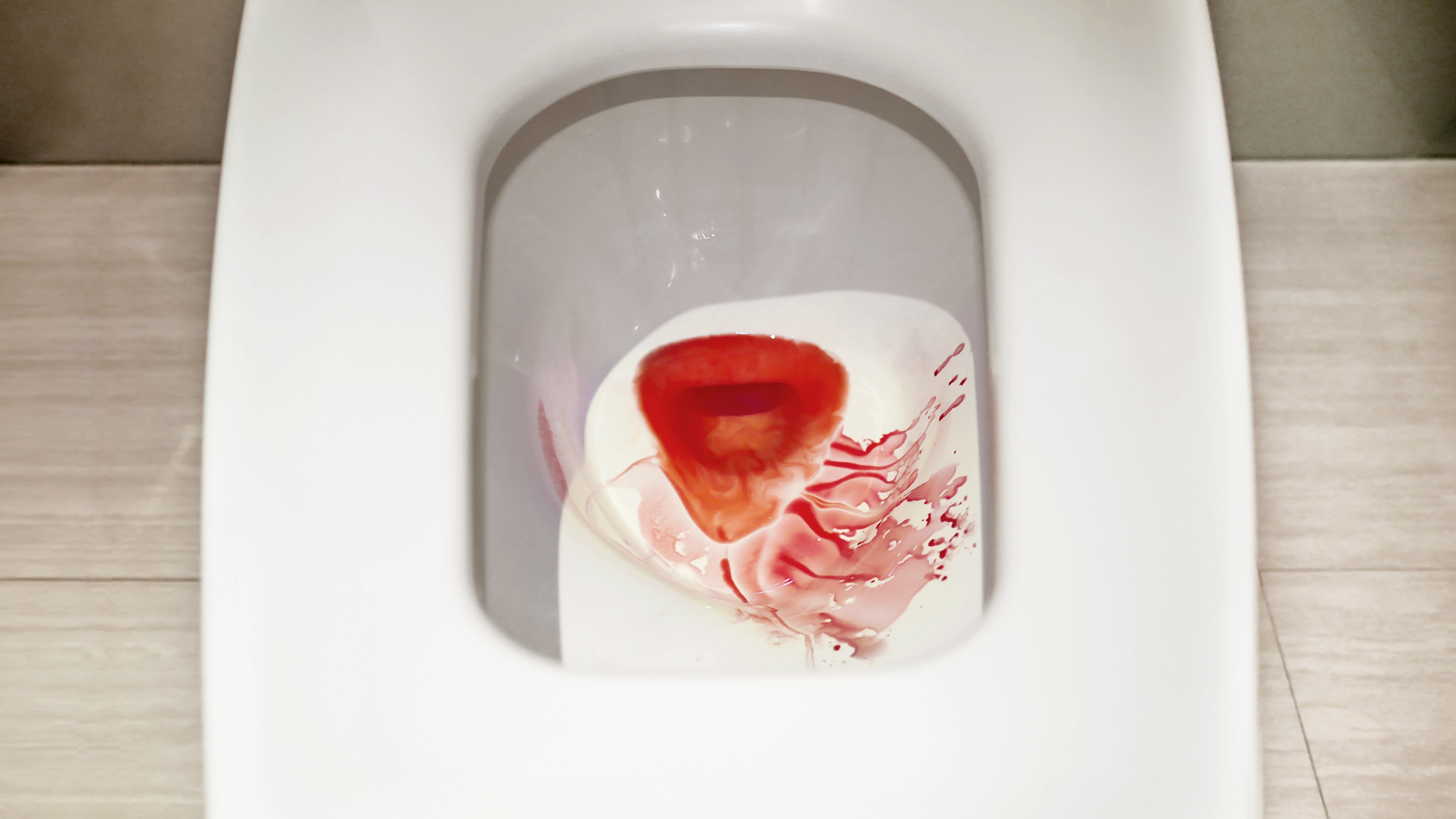 Normal Urine In Toilet