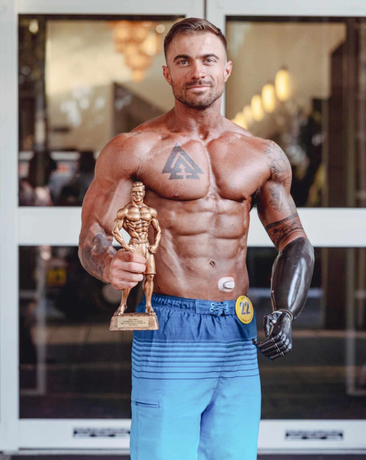 Chris Ruden is pictured wearing his prosthetic arm and holding a powerlifting trophy in his other hand.
