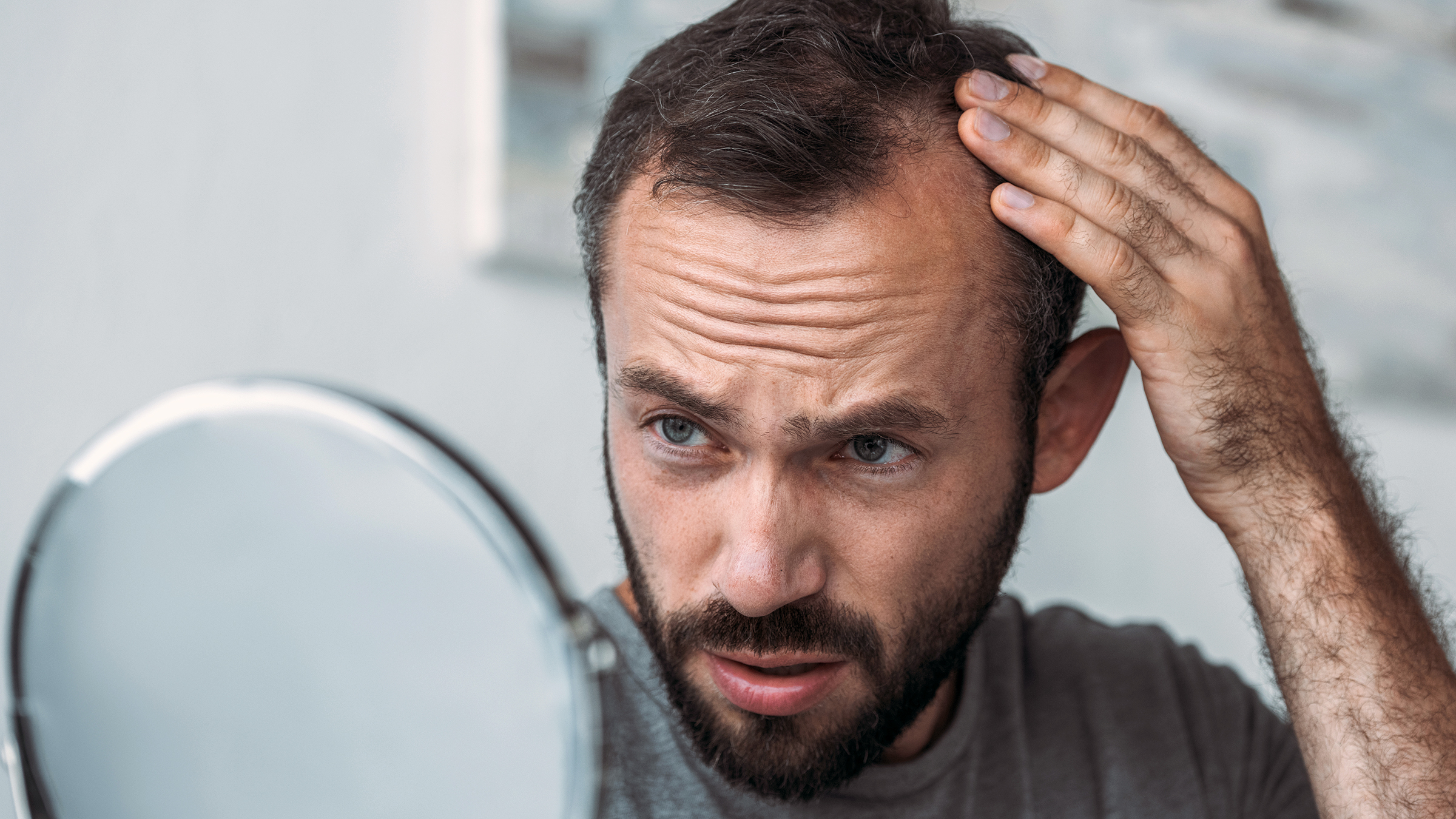 Hair Loss in Men: How to Treat It and See the Signs - GoodRx