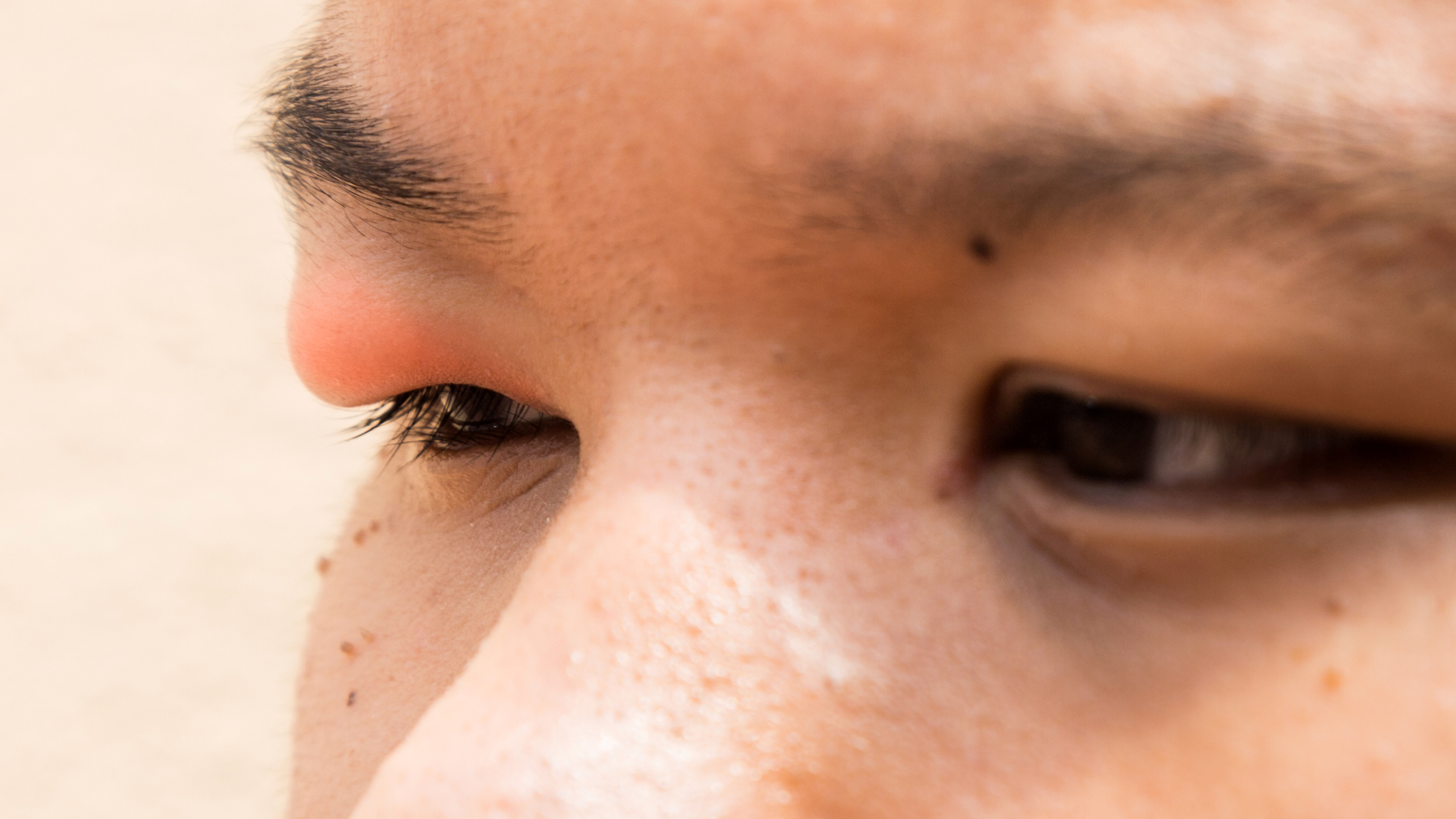 Eye pain: closeup man with stye 497348668