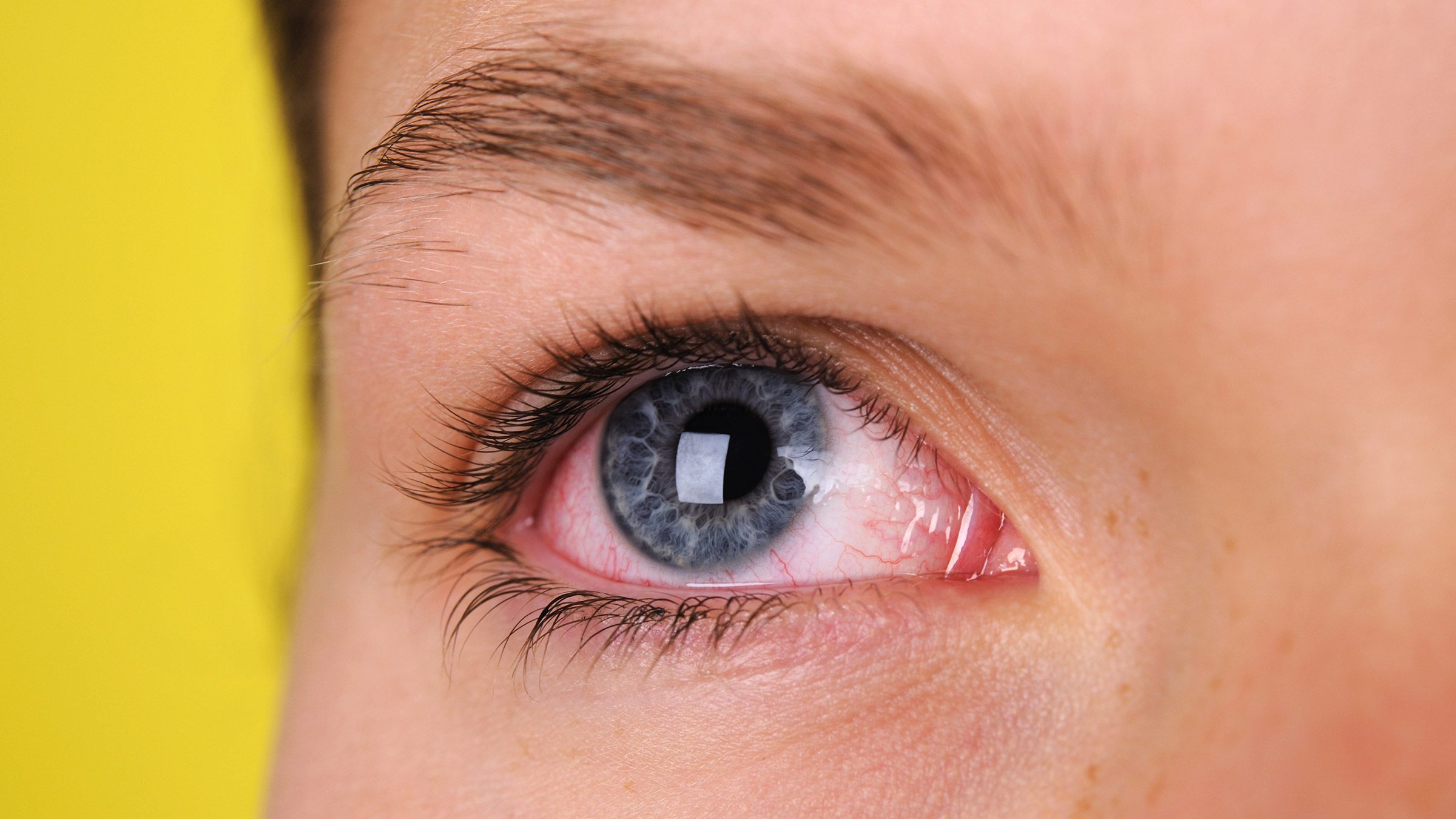 fugtighed wafer Tåre What Can Cause Red Eyes? How Do You Treat Them? - GoodRx