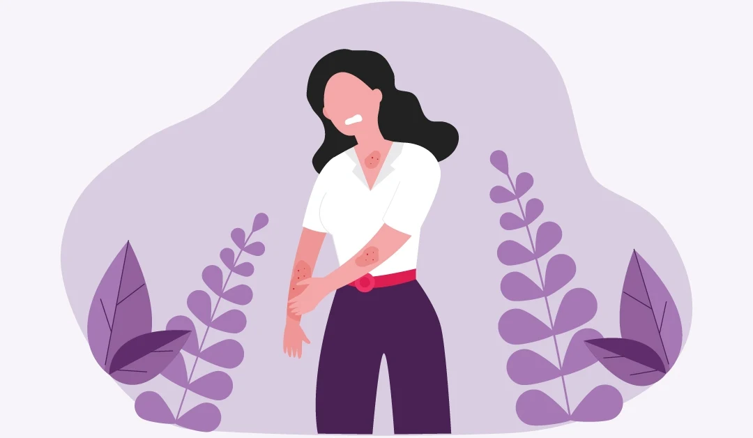 4 Things a Dermatologist Wants You To Know About Eczema Management