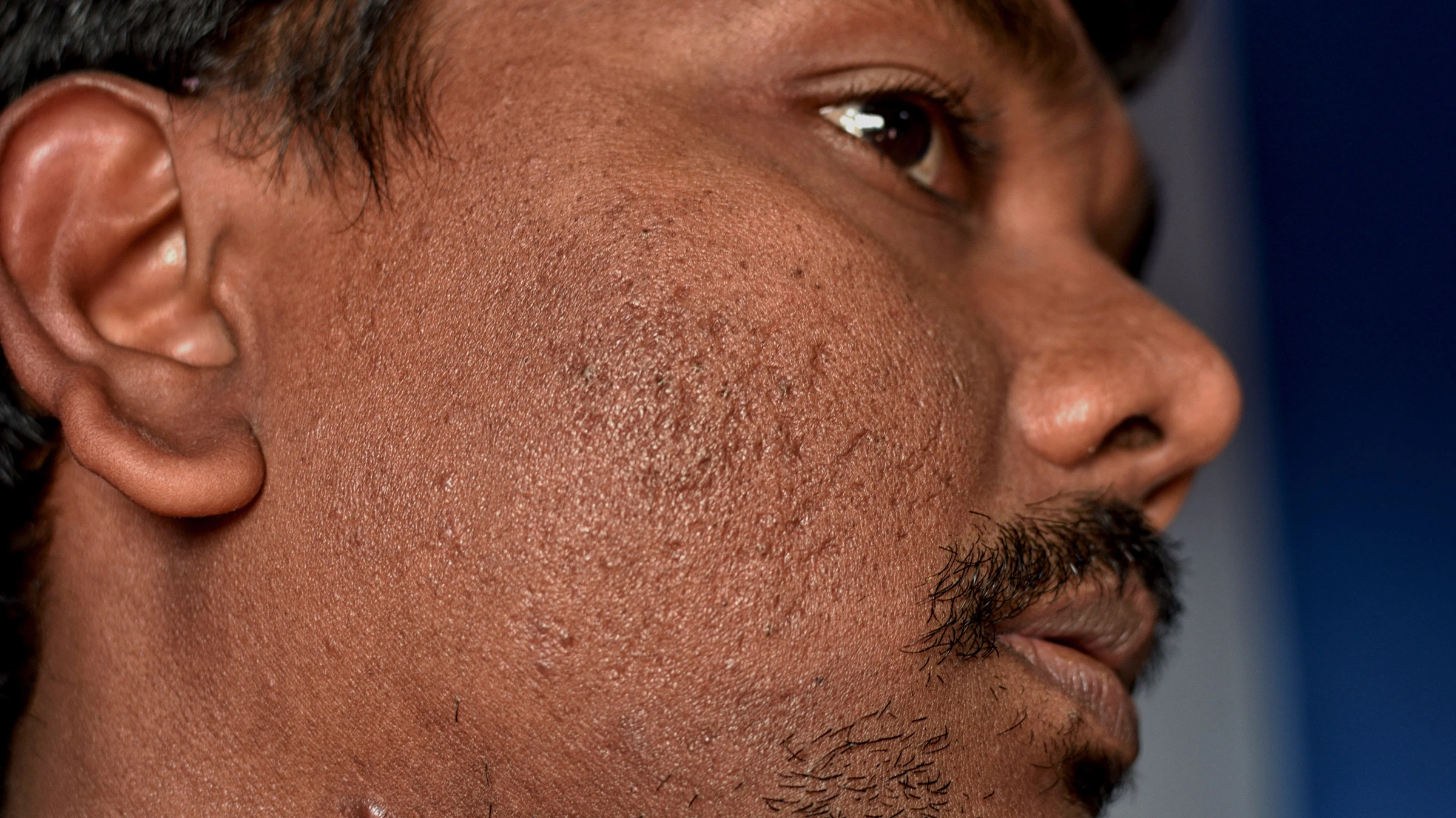 acetyl l carnitine causes acne Frontline Formulations L-Carnitine – Fitness Society Supplements main image 0