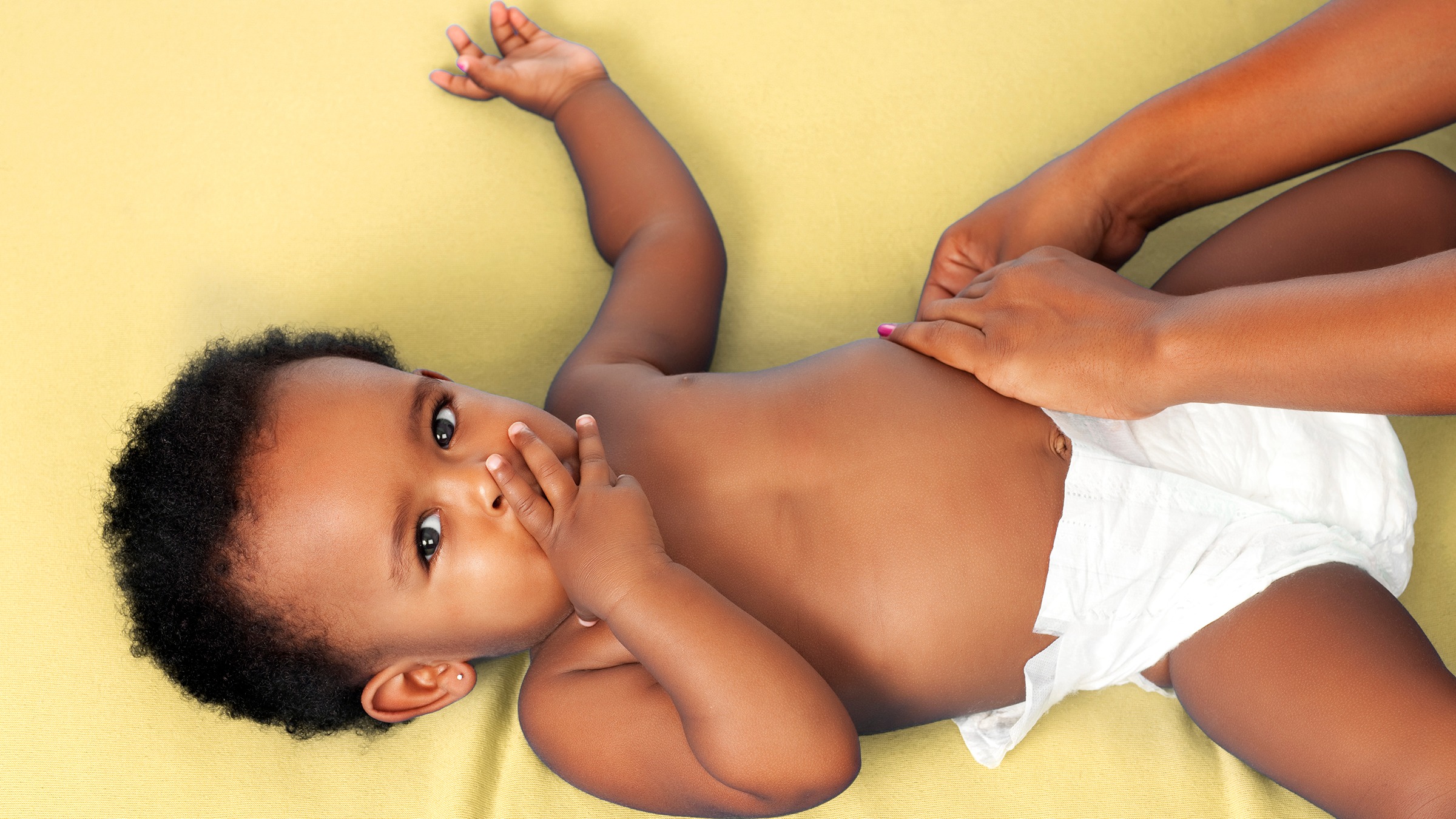 Are disposable diapers more likely than cloth diapers to cause diaper rash?