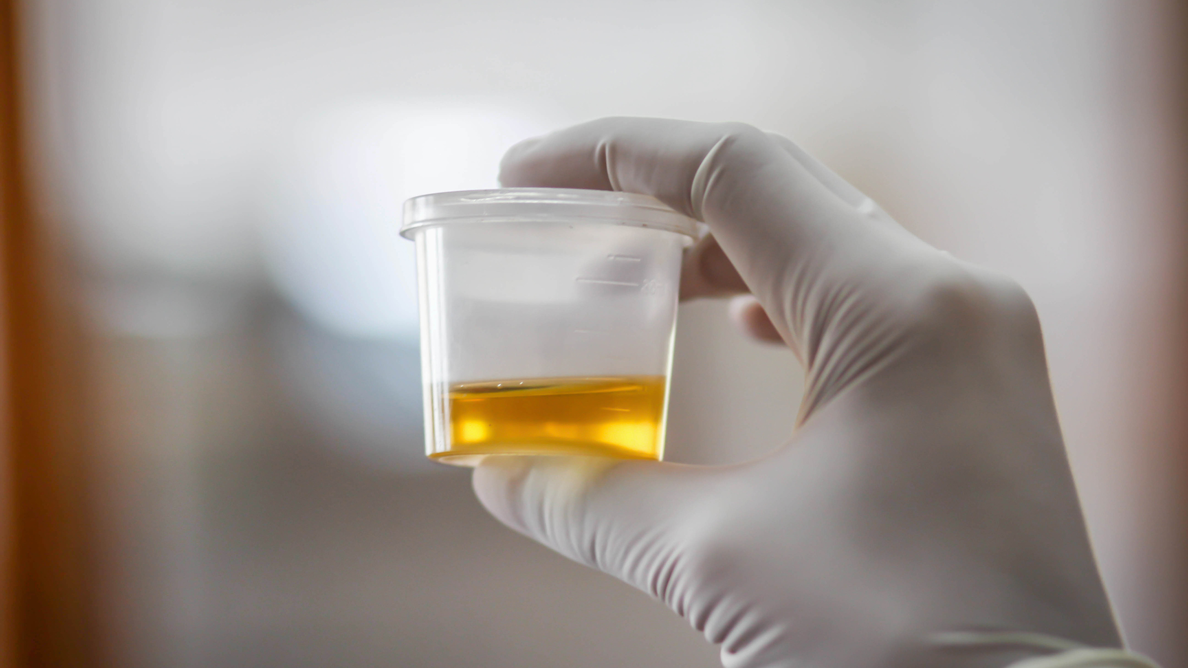 urine test