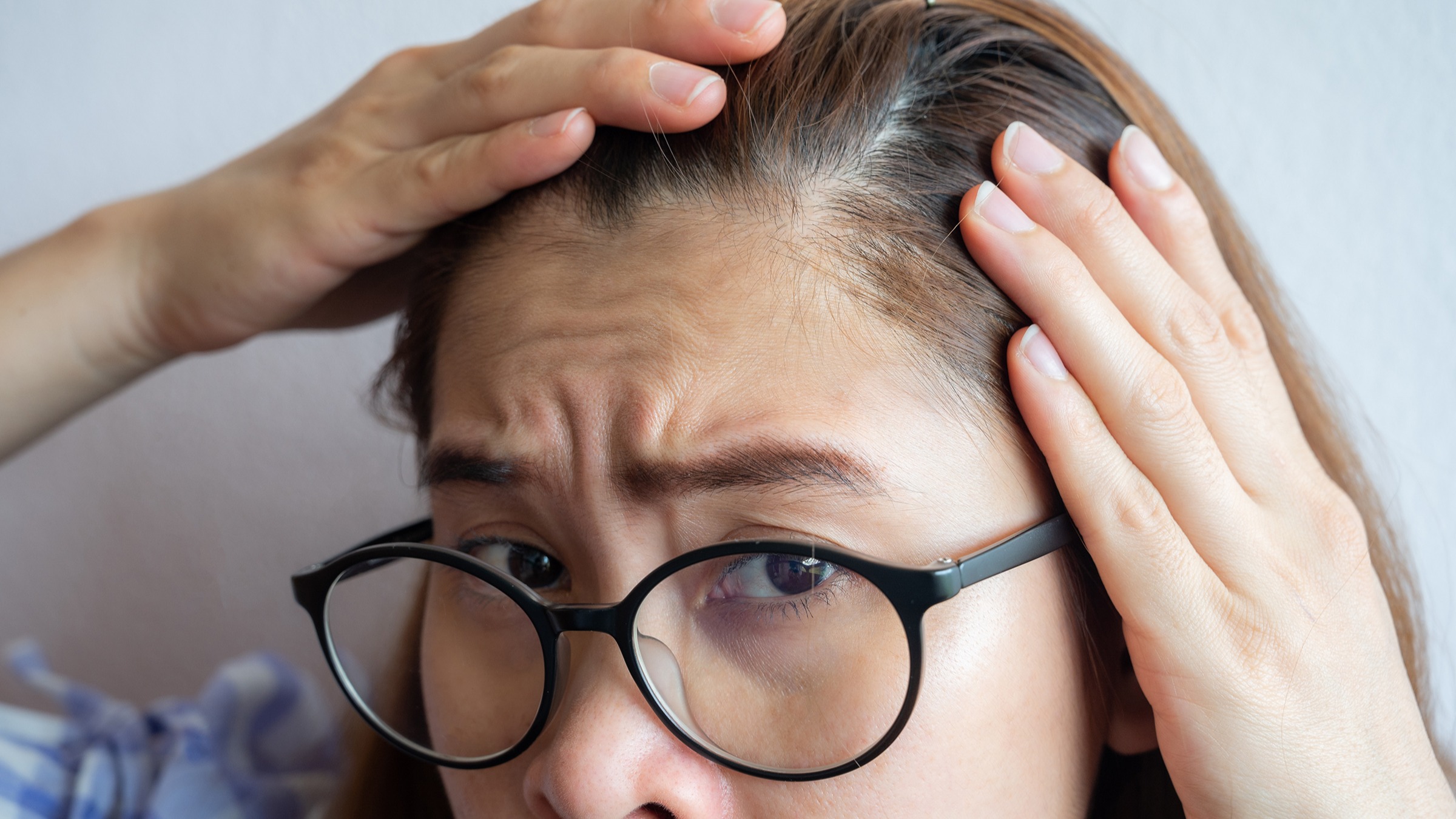 How many hairs are on a human head  myhair