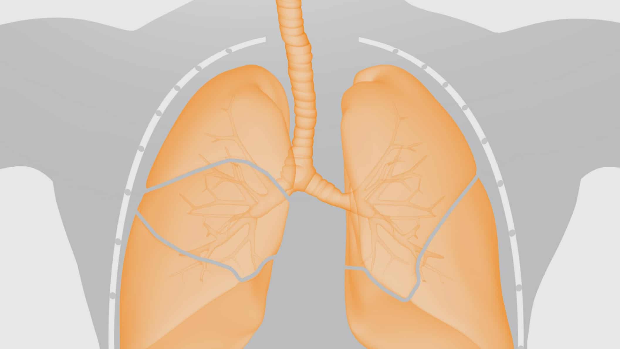 IMMUNOTHERAPY FOR LUNG CANCER NAMES visual data 2