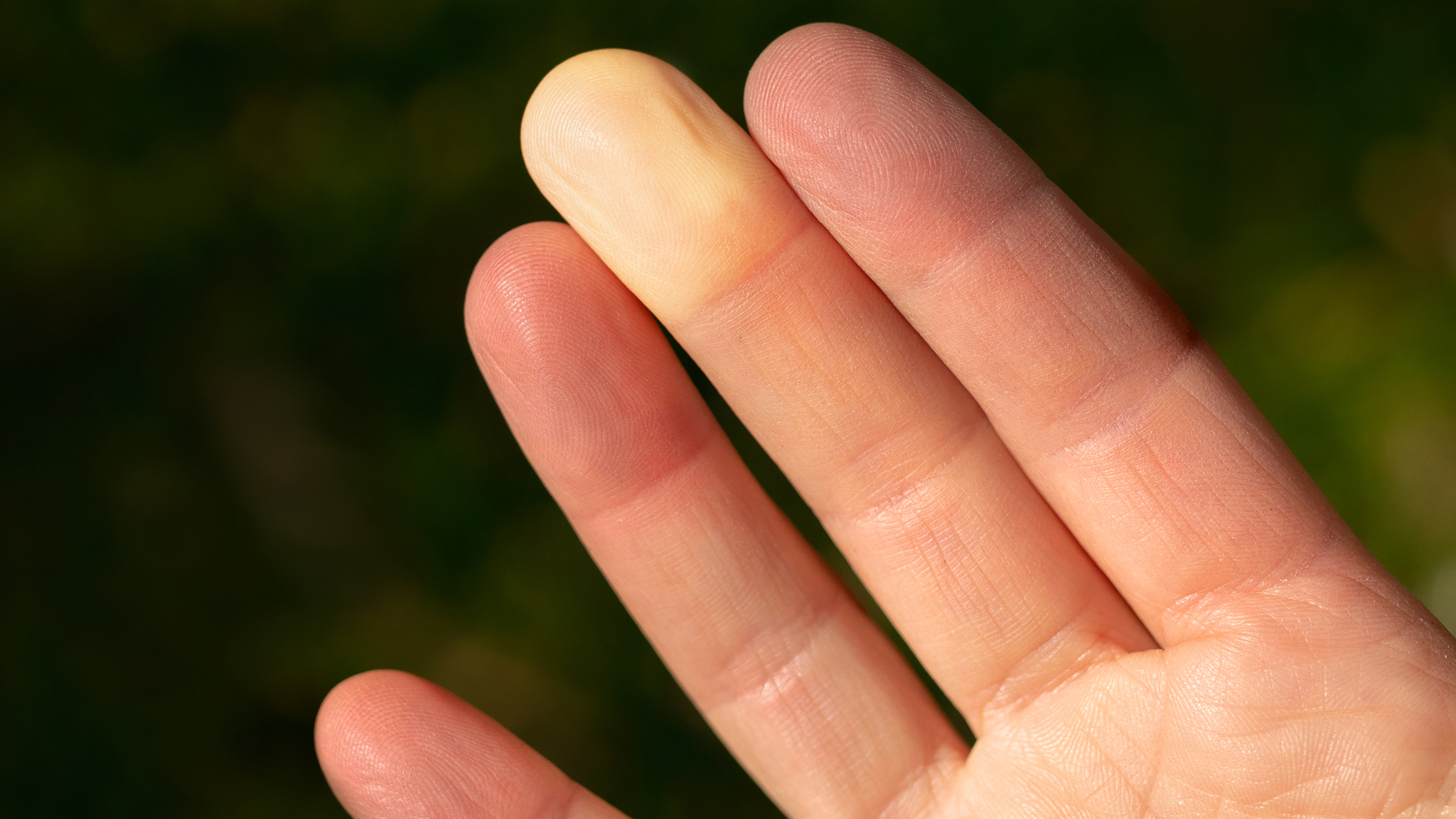 Fingers that change color Information