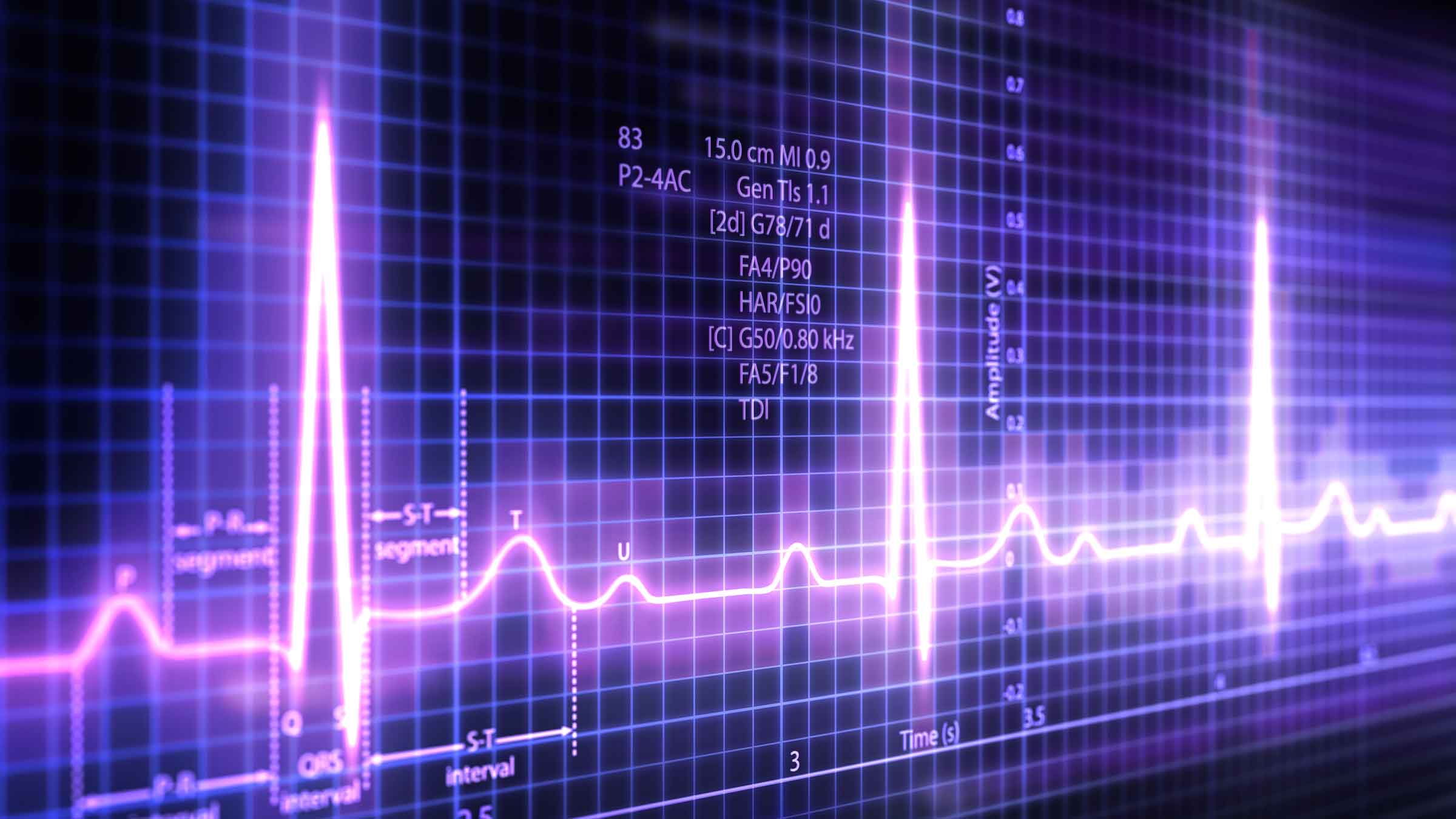 left-bundle-branch-blocks-on-ekgs-testing-and-treatment-goodrx