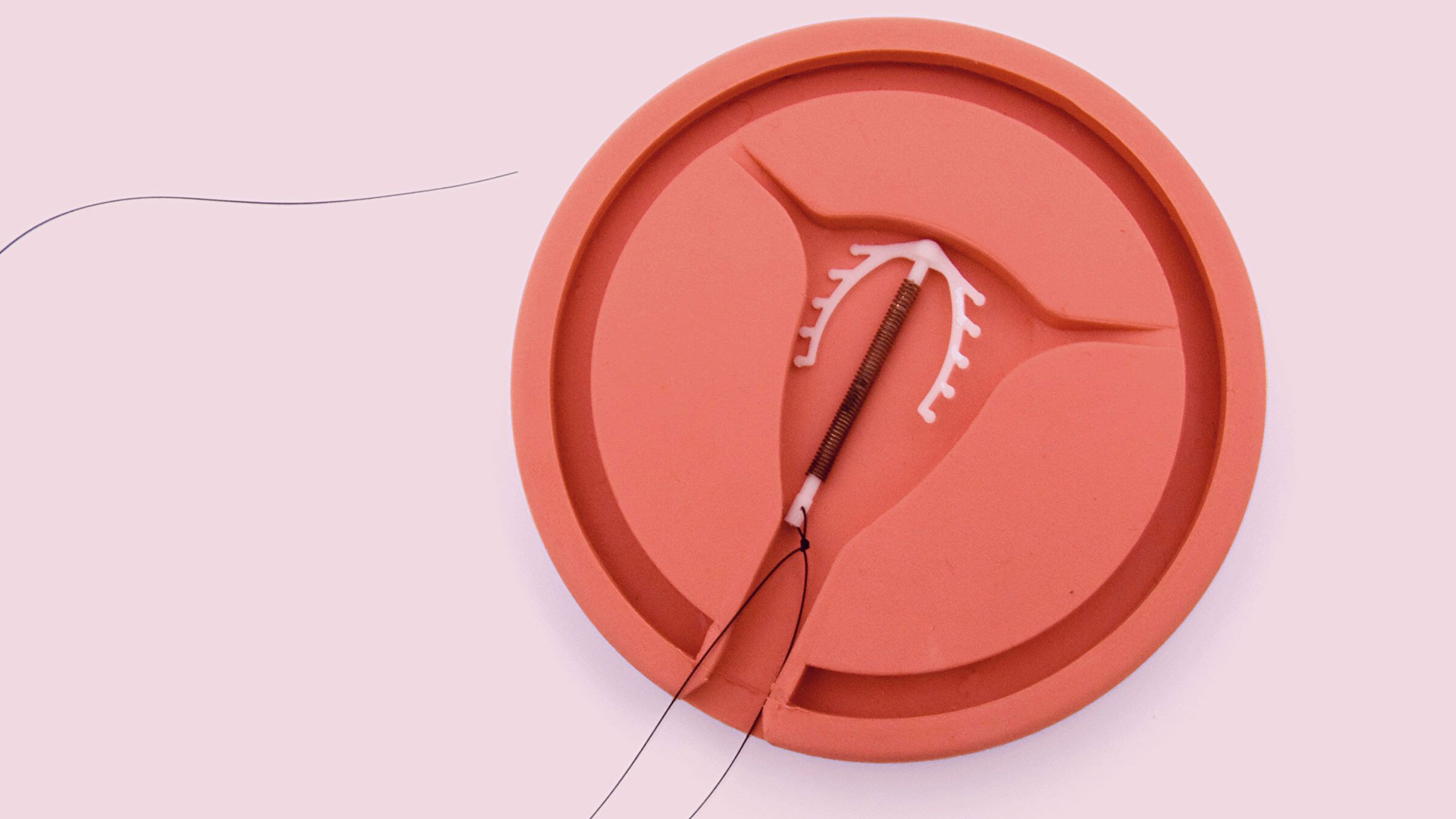 Do IUDs Cause Weight Gain? Here Are the Facts - GoodRx