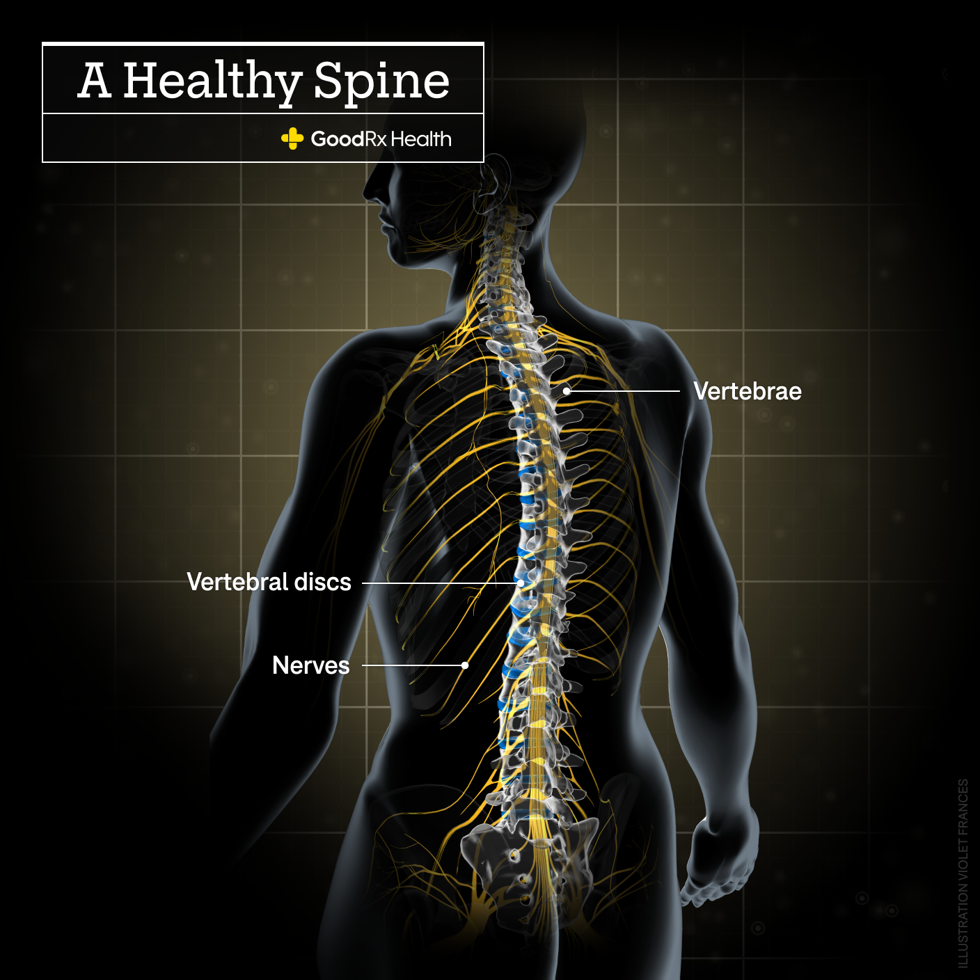 A 3D illustration of a healthy spine including vertebrae, vertebral discs, and nerves.