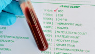 The Meaning Of Complete Blood Count CBC Abbreviations GoodRx