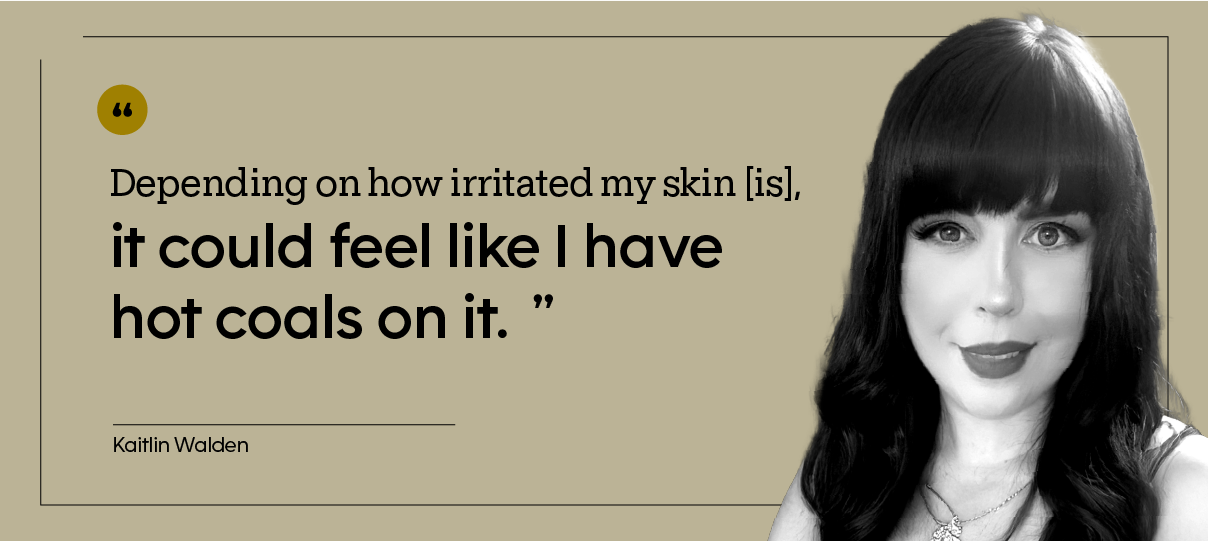“Depending on how irritated my skin [is], it could feel like I have hot coals on it.” — Kaitlin Walden