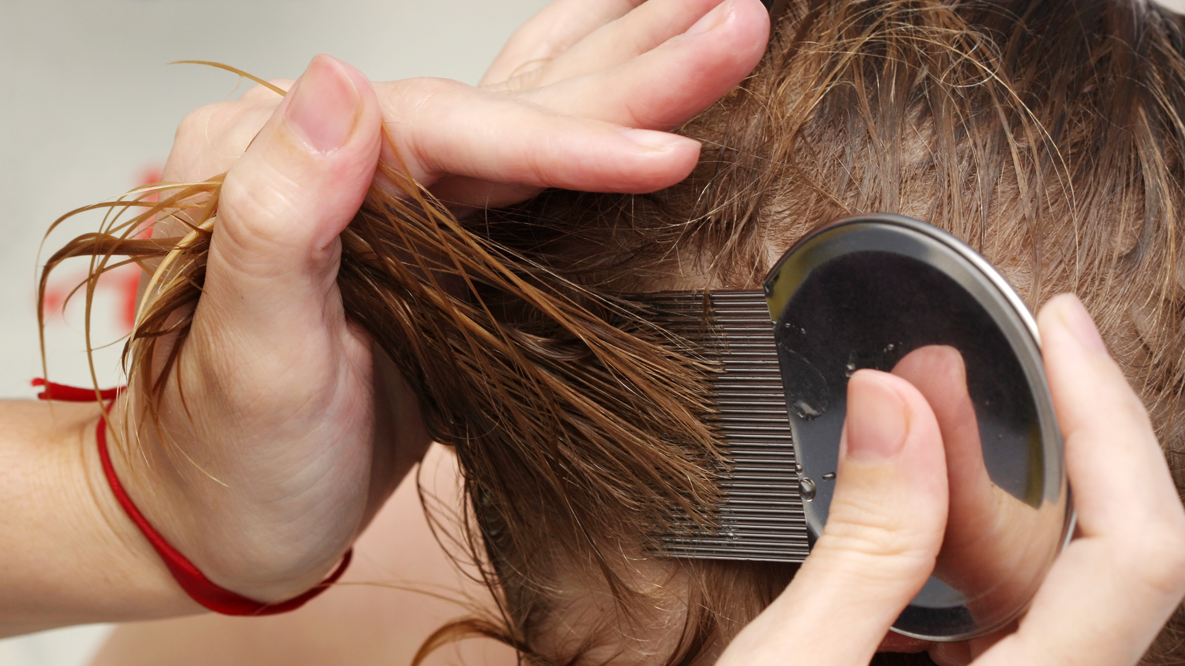 How Much Does Lice Removal Treatment Cost? GoodRx