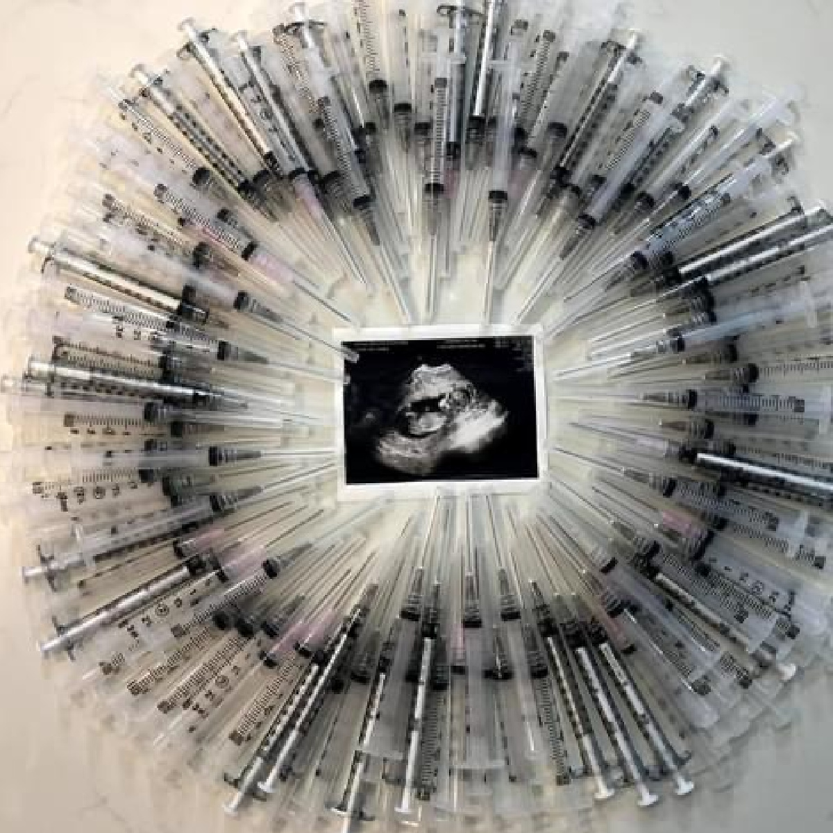 An ultrasound picture of Kirsten Kozak’s unborn baby is surrounded by empty needles from her fertility shots.