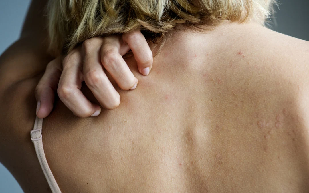 How Gabapentin Can Treat Shingles