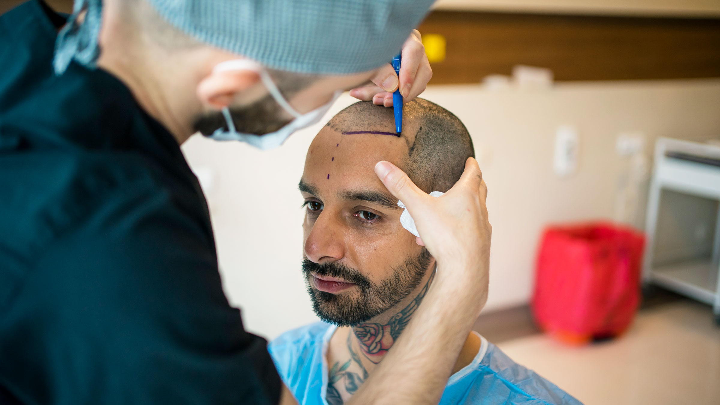 Hair Transplant Death Rate Should You Be Worried