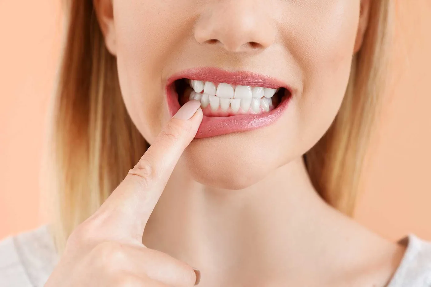 Image - Article - Erosión del esmalte: causas, síntomas y tratamientos