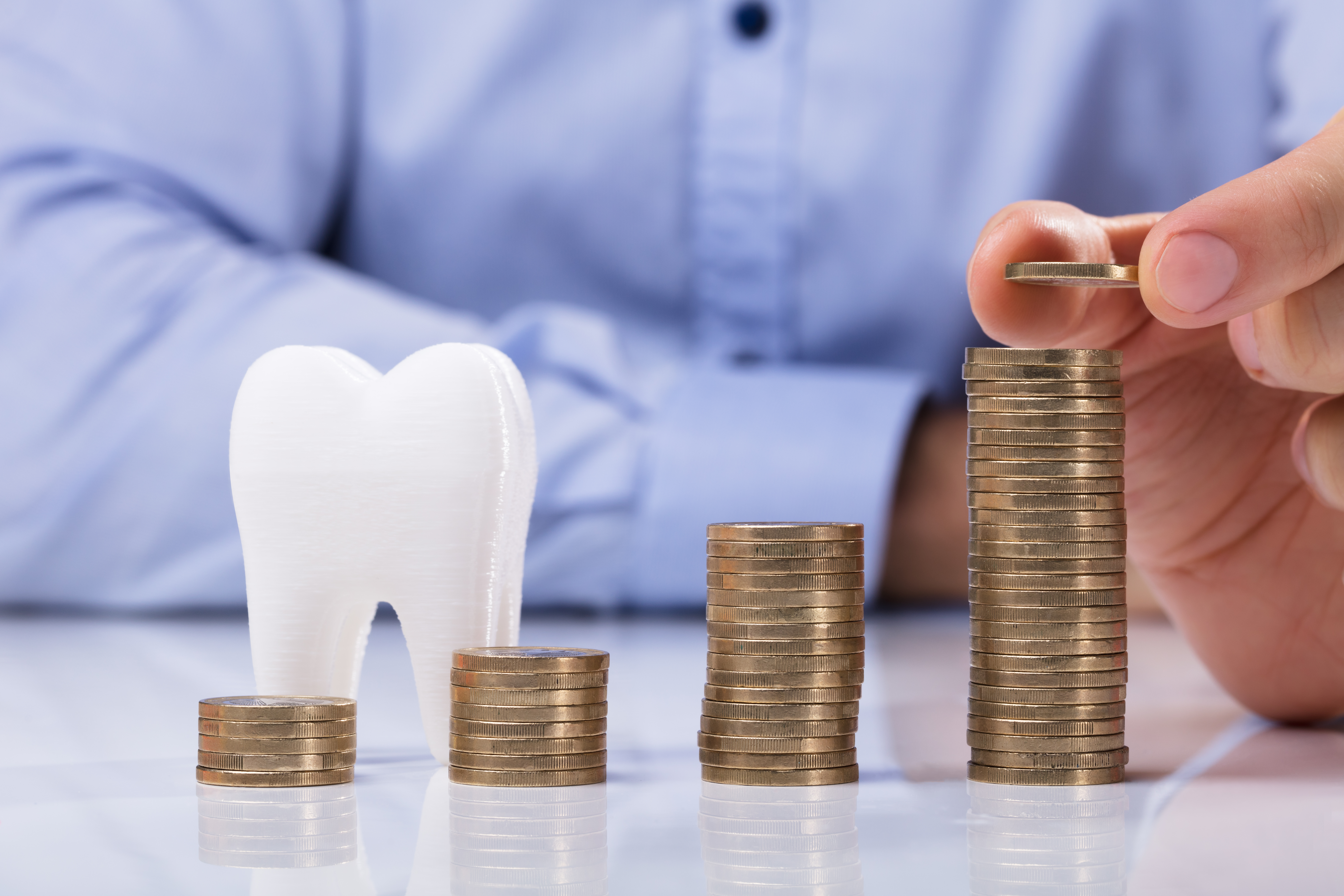 ¿Cuánto cuestan los implantes dentales?