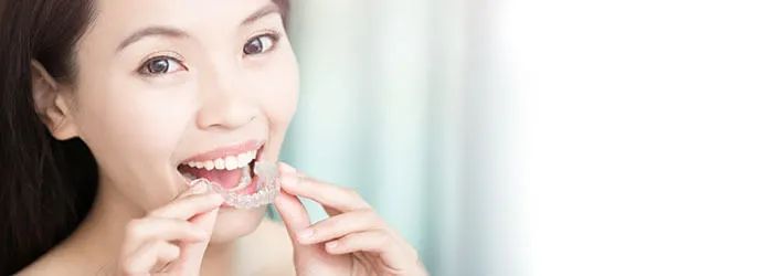 Image - Article Hero - Retenedor Dental Para Enderezar Los Dientes - ES-ES article banner