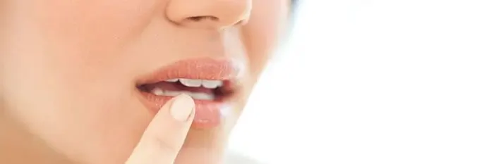 Herpes Labial: Causas, Síntomas y Tratamientos