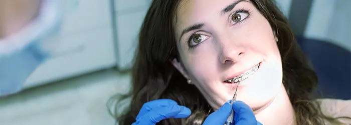 ¿Cuándo ponerse brackets? article link