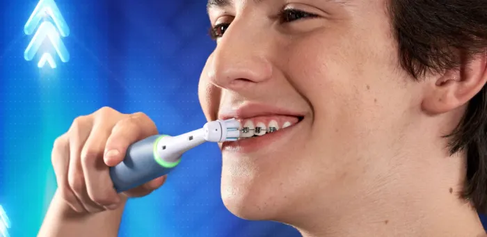 Limpieza Dental Con Brackets: Como Hacerlo