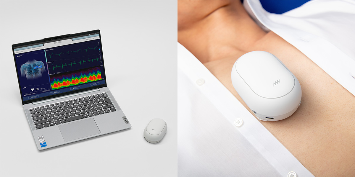 薬事承認】AMIの『心音図検査装置AMI-SSS01シリーズ』がワイヤレス