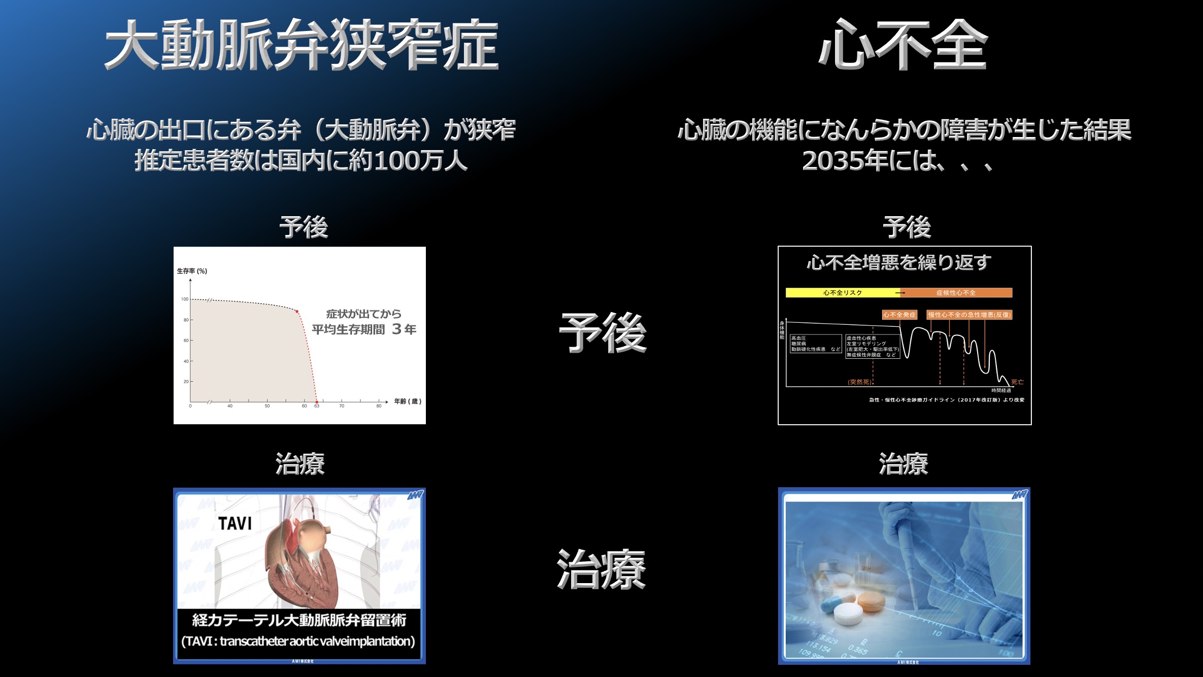 男女兼用 中古 単行本 実用 健康 医療 冠動脈疾患の手術 タイムセール 中古 Afb 本 雑誌 コミック Wcsw Org