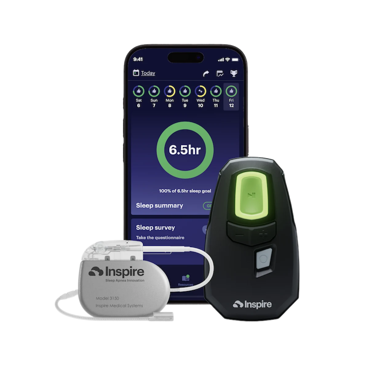 Inspire therapy remote, app and implant