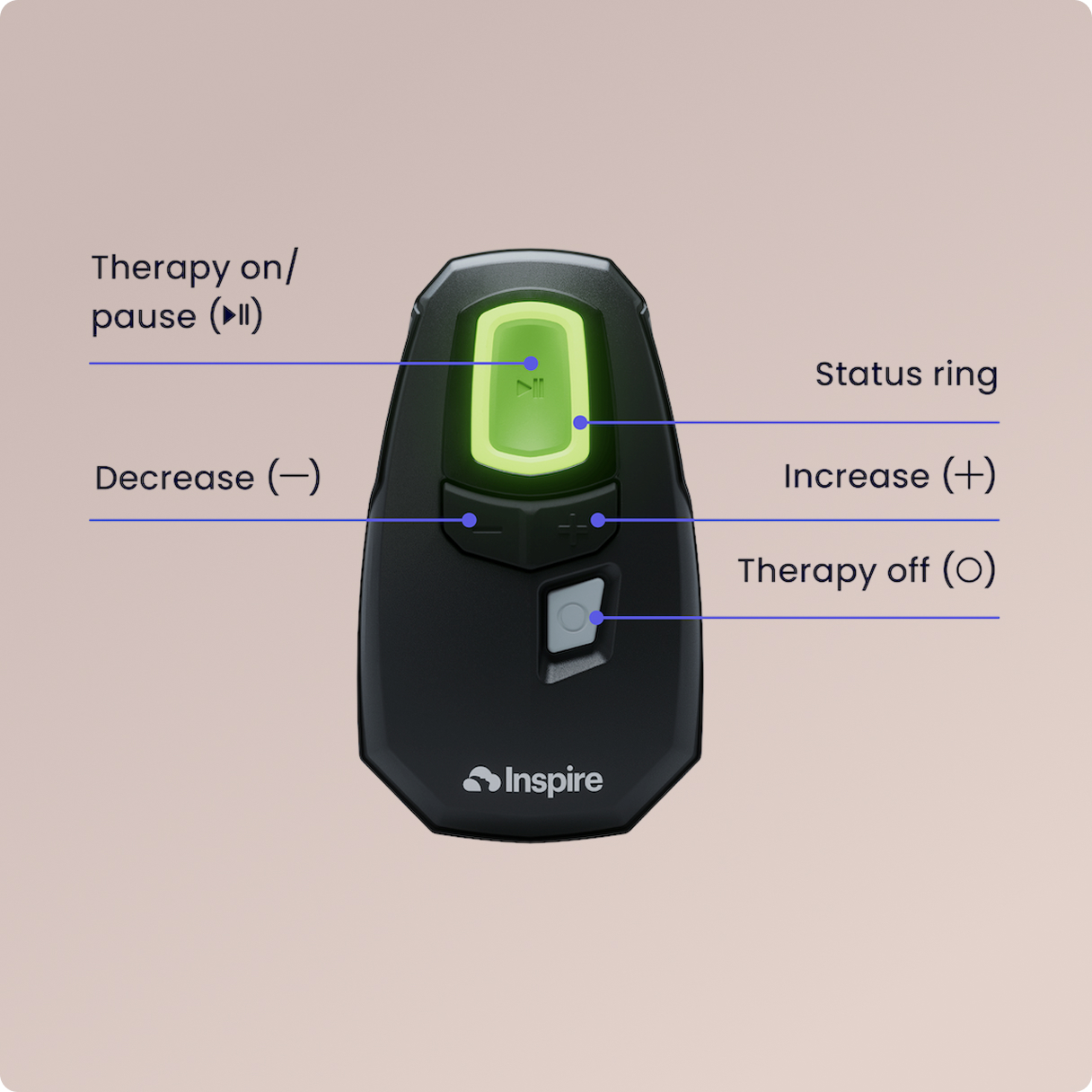 Inspire™ remote | Inspire Sleep Apnea Innovation
