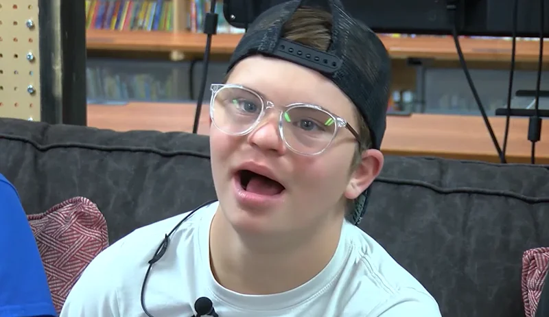  Child with Down syndrome treats obstructive sleep apnea, has dramatic life changes