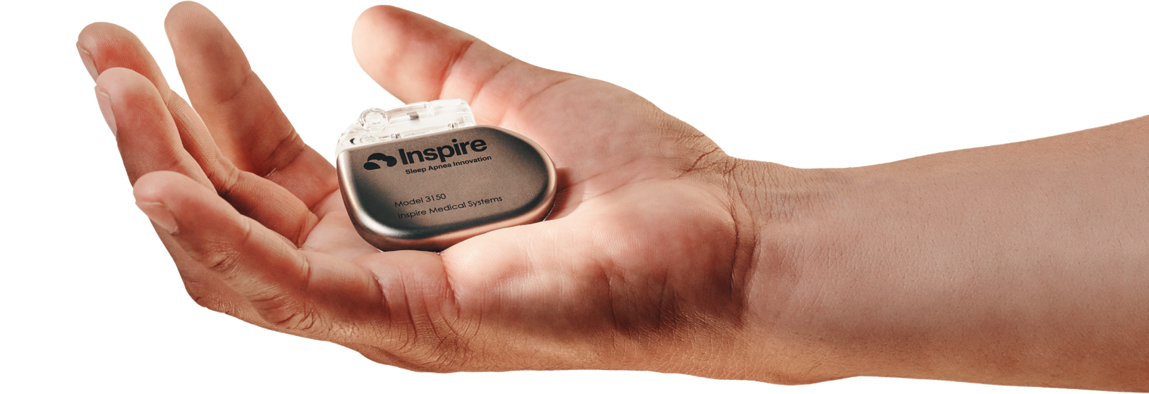 Sleep Apnea Treatment | Inspire® therapy