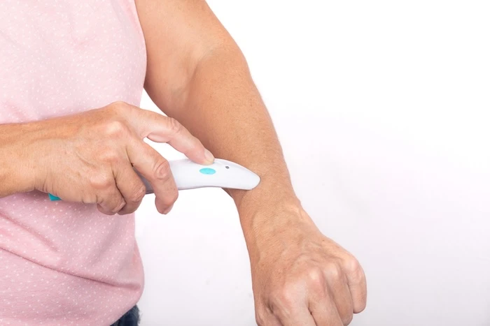 Schmuckbild: Ein Mann, der einen Mückenstich am Arm mit einem Hitzestift behandelt.