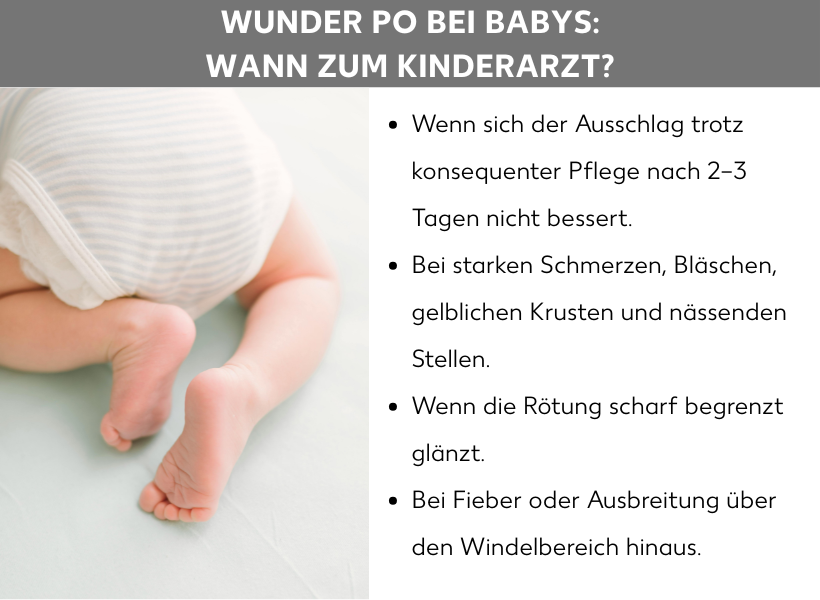 Infografik: Wunder Po bei Babys: Wann zum Kinderarzt? Listenpunkte: Wenn sich der Ausschlag trotz konsequenter Pflege nach 2–3 Tagen nicht bessert. Bei starken Schmerzen, Bläschen, gelblichen Krusten und nässenden Stellen. Wenn die Rötung scharf begrenzt glänzt. Bei Fieber oder Ausbreitung über den Windelbereich hinaus.