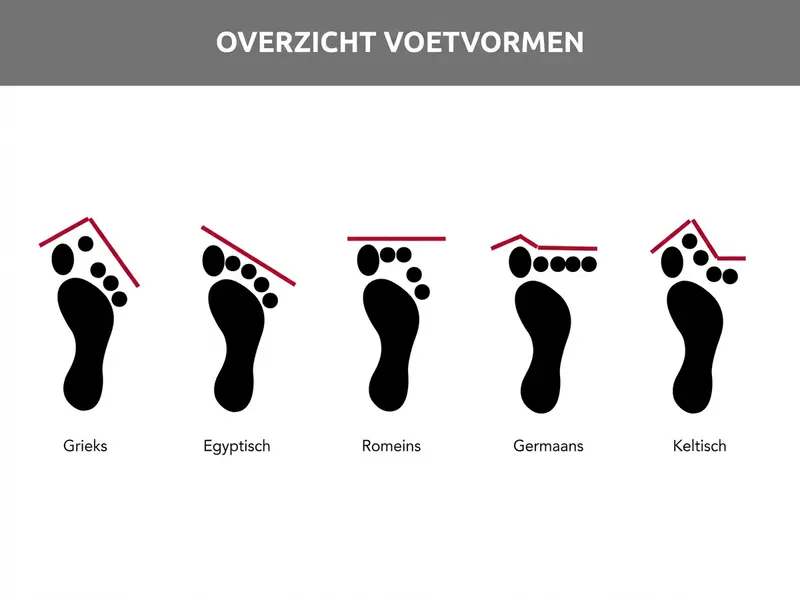 Overzicht voetvormen