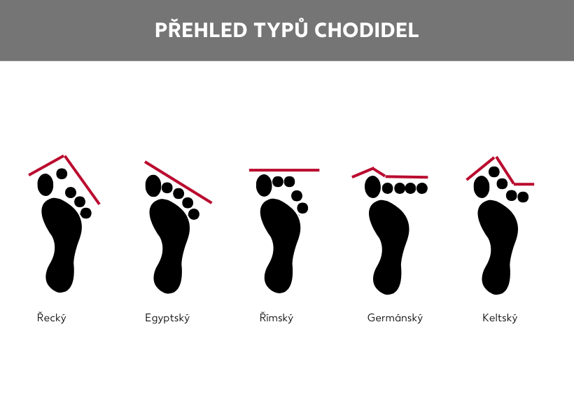 Přehled typů chodidel