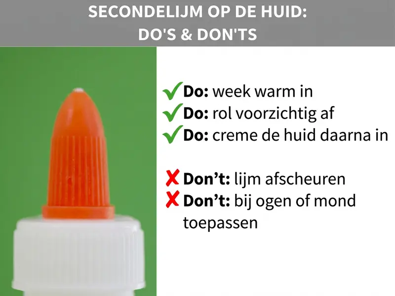 Infographic: Secondenlijm op de huid: do's & don'ts. Links in beeld de oranje punt van een tube secondenlijm voor een groene achtergrond. Rechts een lijst met drie do's, elk gemarkeerd met een groen vinkje: Do: warm inweken. Do: voorzichtig afrollen. Do: huid daarna insmeren. Daaronder twee don'ts, elk gemarkeerd met een rood kruis: Don't: lijm lostrekken. Don't: bij ogen of mond toepassen.