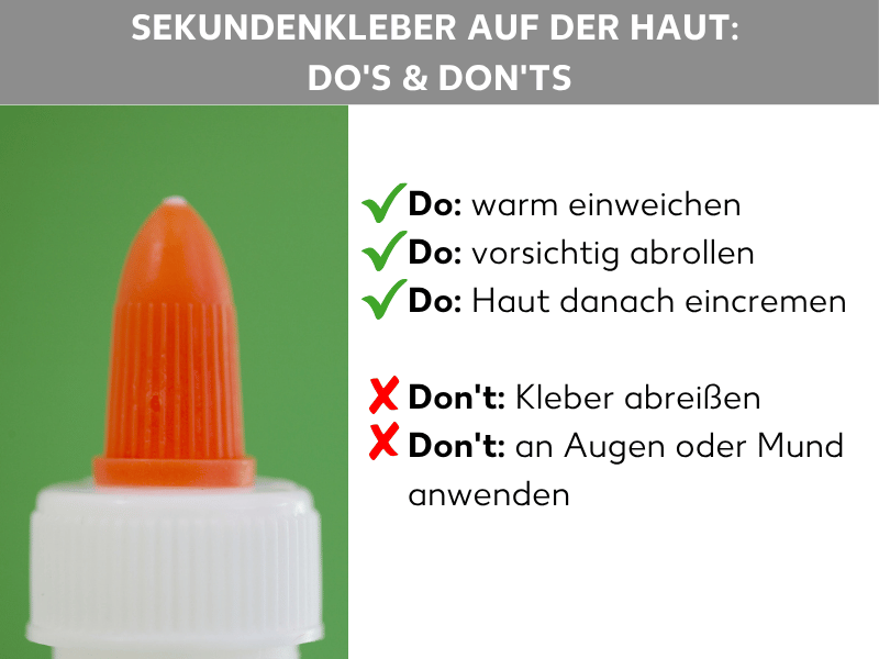 Infografik: Sekundenkleber auf der Haut: Do's & Don'ts. Links im Bild die orangefarbene Spitze einer Sekundenkleber-Tube vor grünem Hintergrund. Rechts eine Liste mit drei Do's, jeweils mit grünem Häkchen markiert: Do: warm einweichen. Do: vorsichtig abrollen. Do: Haut danach eincremen. Darunter zwei Don'ts, jeweils mit rotem Kreuz markiert: Don't: Kleber abreißen. Don't: an Augen oder Mund anwenden.