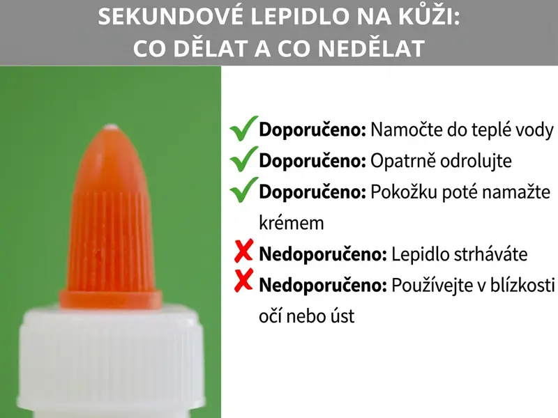 Infografika: Sekundové lepidlo na kůži – co dělat a čeho se vyvarovat. Vlevo na obrázku oranžová špička tuby se sekundovým lepidlem na zeleném pozadí. Vpravo seznam tří doporučení, každé označené zelenou fajfkou: Doporučení: namočte do teplé vody. Doporučení: opatrně odrolujte. Doporučení: poté pokožku nakrémujte. Pod nimi dvě varování, každé označené červeným křížkem: Nedělat: lepidlo strhávat. Nedělat: používat v okolí očí nebo úst.
