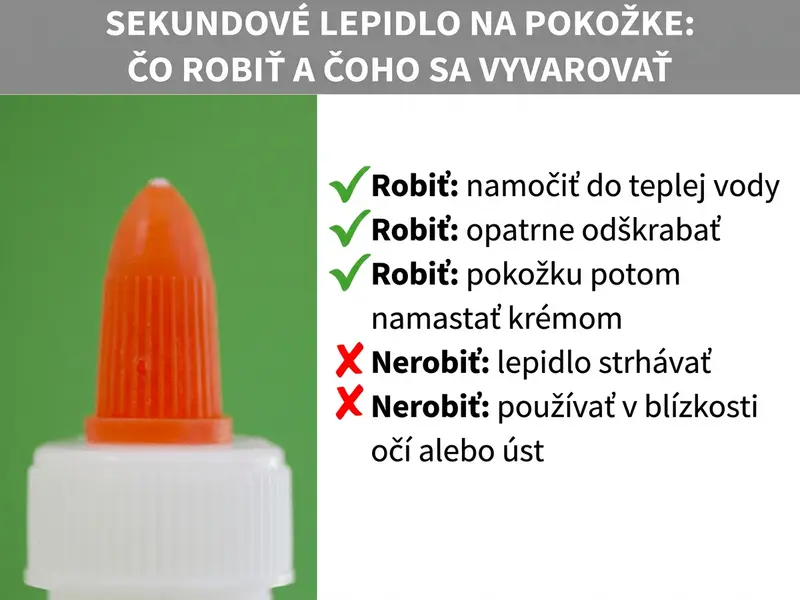 Infografika: Sekundové lepidlo na pokožke – čo robiť a čo nie. Vľavo na obrázku oranžová špička tuby so sekundovým lepidlom na zelenom pozadí. Vpravo zoznam troch odporúčaní, každé označené zelenou fajkou: Odporúčanie: namočiť v teplej vode. Odporúčanie: opatrne odrolovať. Odporúčanie: pokožku potom natrieť krémom. Pod tým dve „nie", každé označené červeným krížikom: Nie: lepidlo strhávať. Nie: aplikovať v oblasti očí alebo úst.