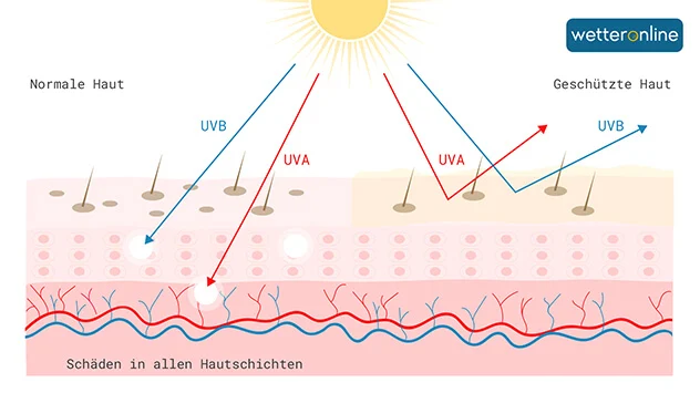 Auswirkung von UV-Strahlung auf geschützte und ungeschützte Haut
