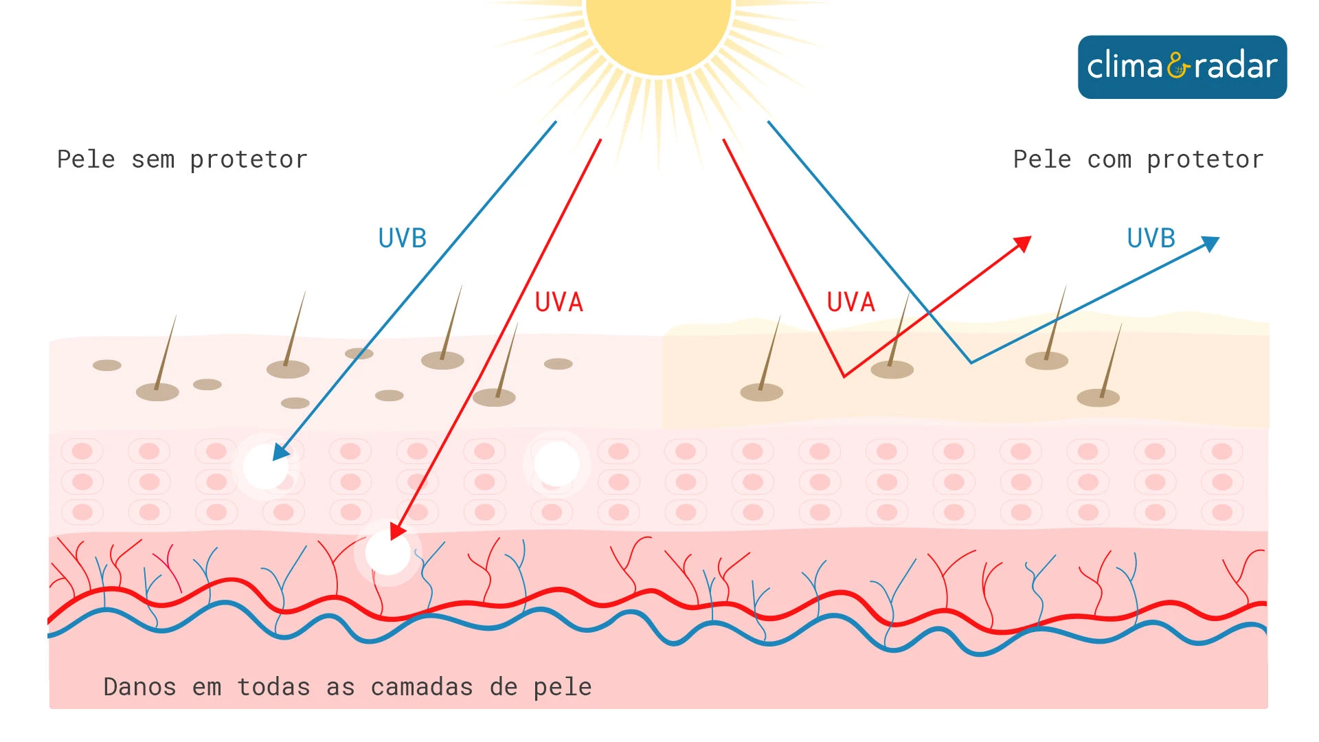 Diferentes tipos de luz UV penetram em camadas distintas da pele. Os raios UVA são menos intensos, porém atingem camadas mais profundas. 