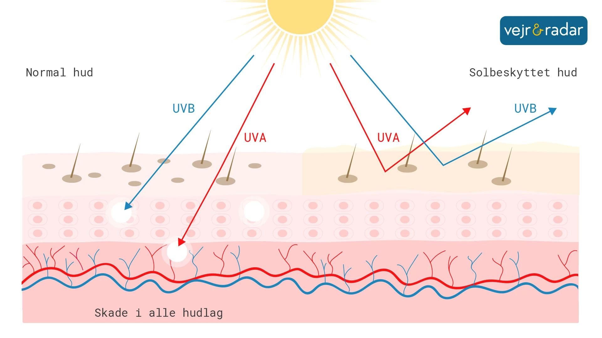 infografik viser Tre typer UV stråler