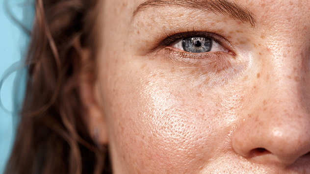 Across our faces and arms Why do freckles come out in the summer? Weather News