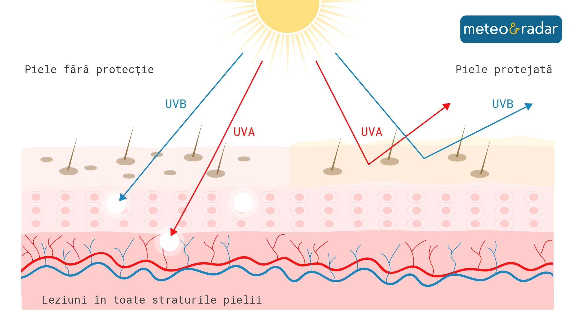 Cum afectează radiațiile ultraviolete pielea