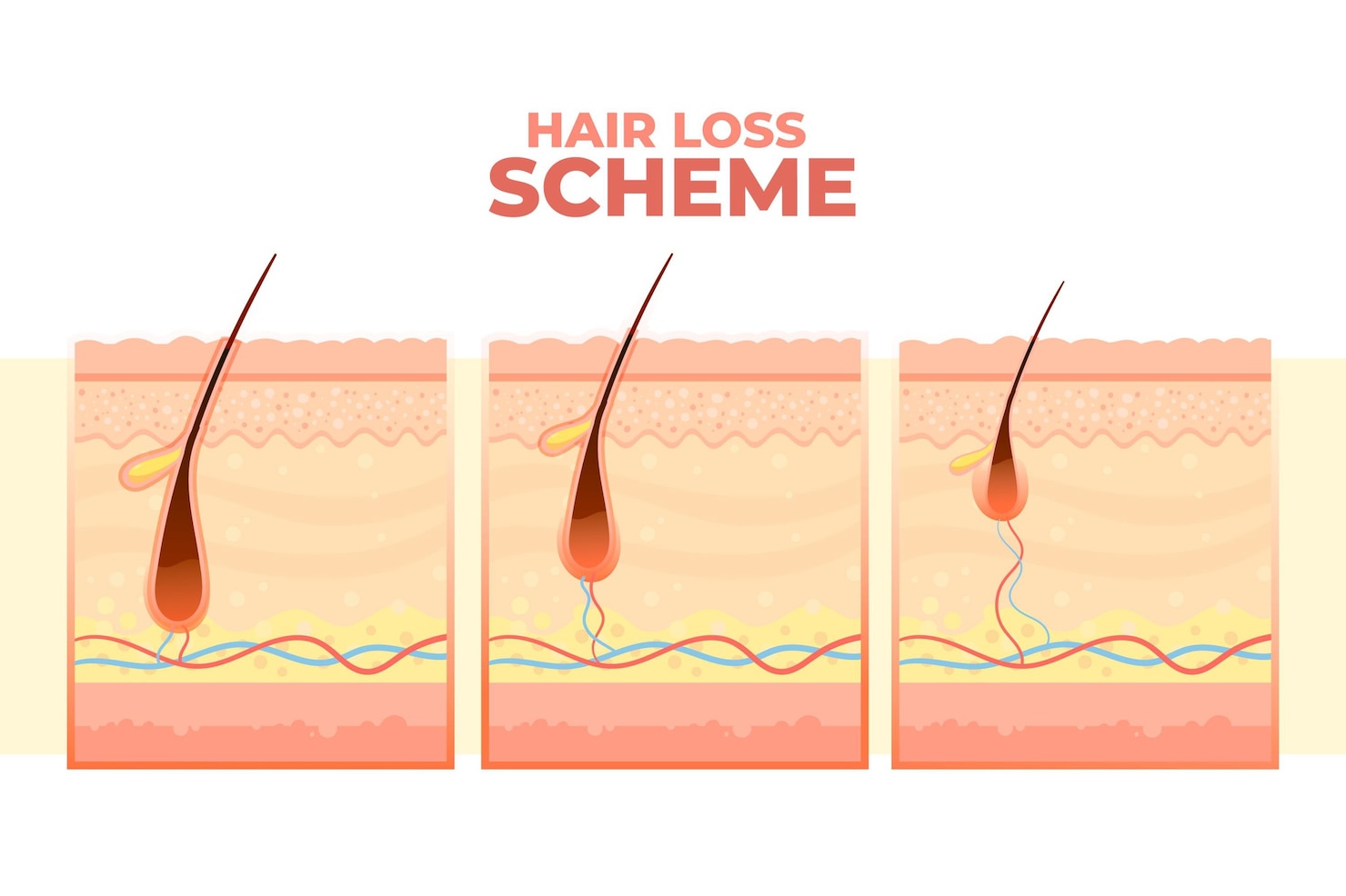 gradient-hair-loss-scheme 23-2148863596