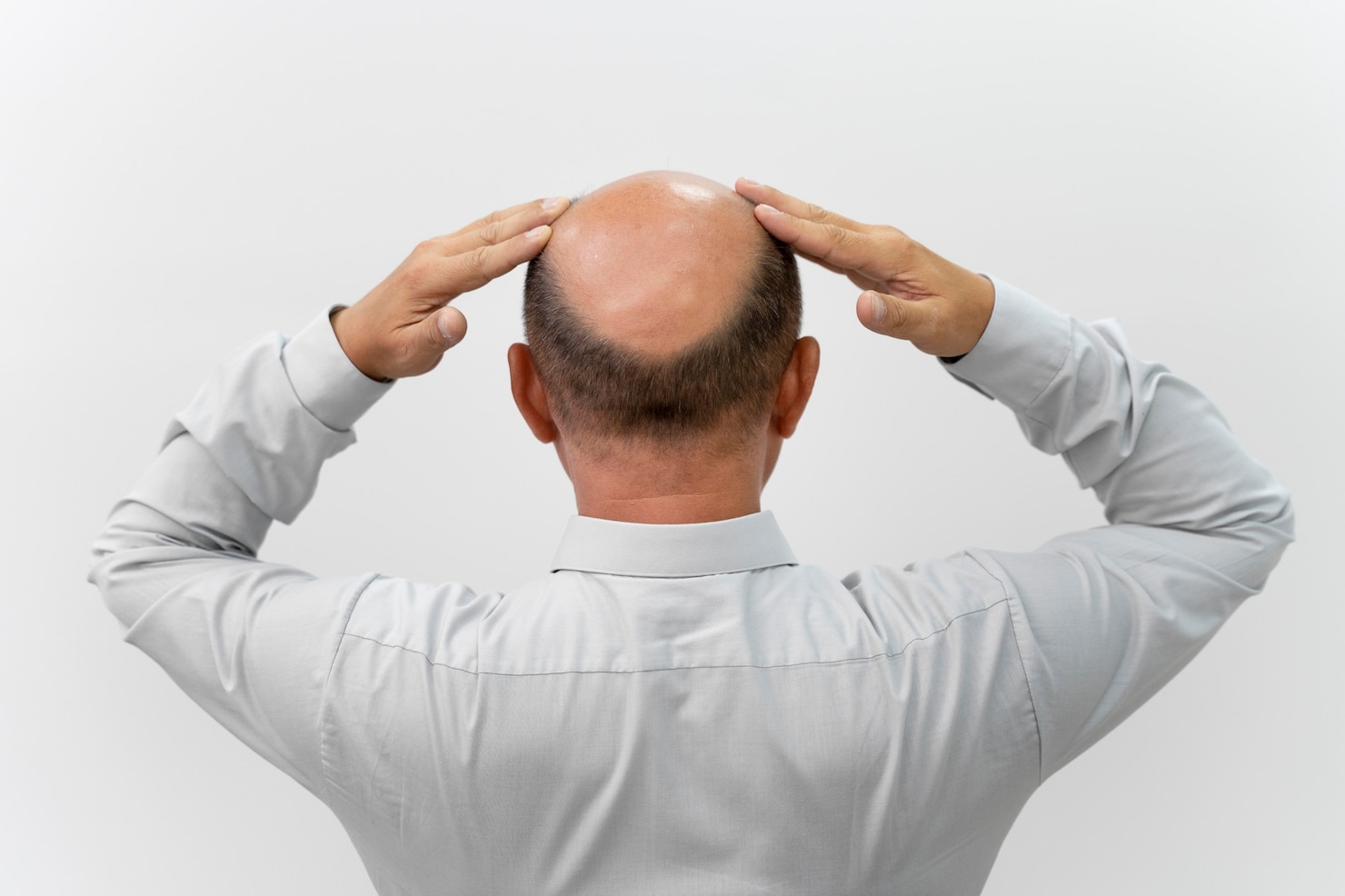 The Truth About Hair Loss: Does Testosterone Cause Hair Loss?